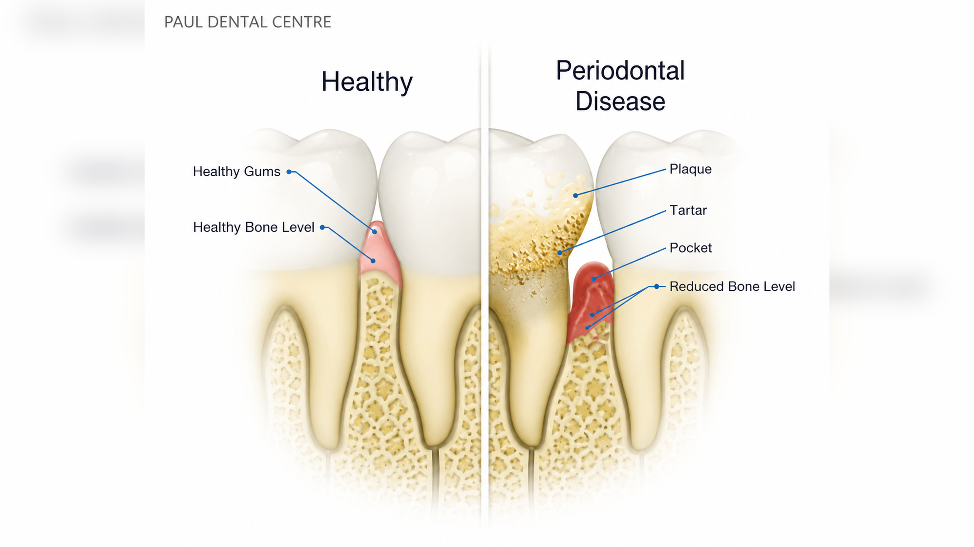 Comprehensive Periodontal Assessments